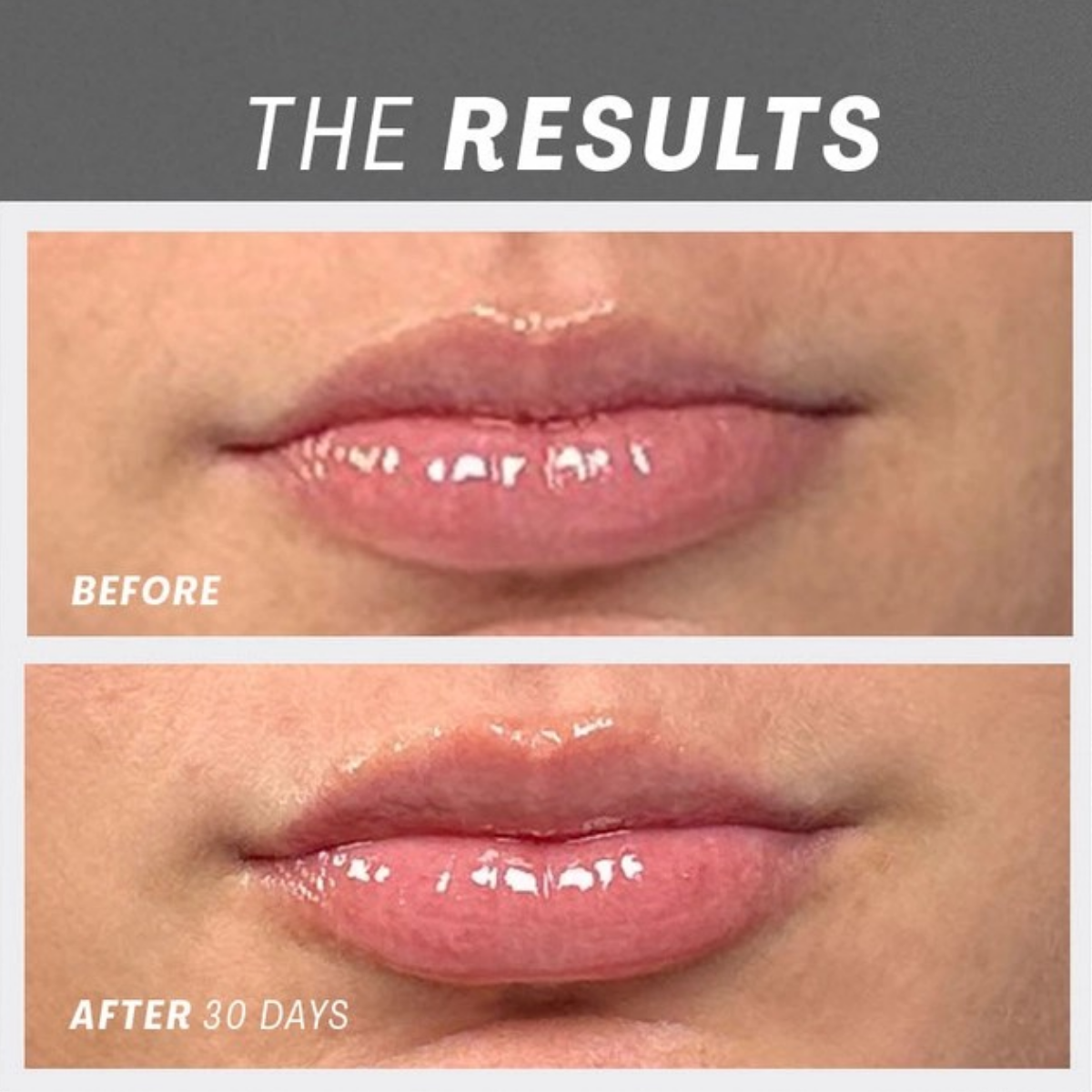 The Outset | Lip Oasisᵀᴹ Glossy Treatment - Image 5