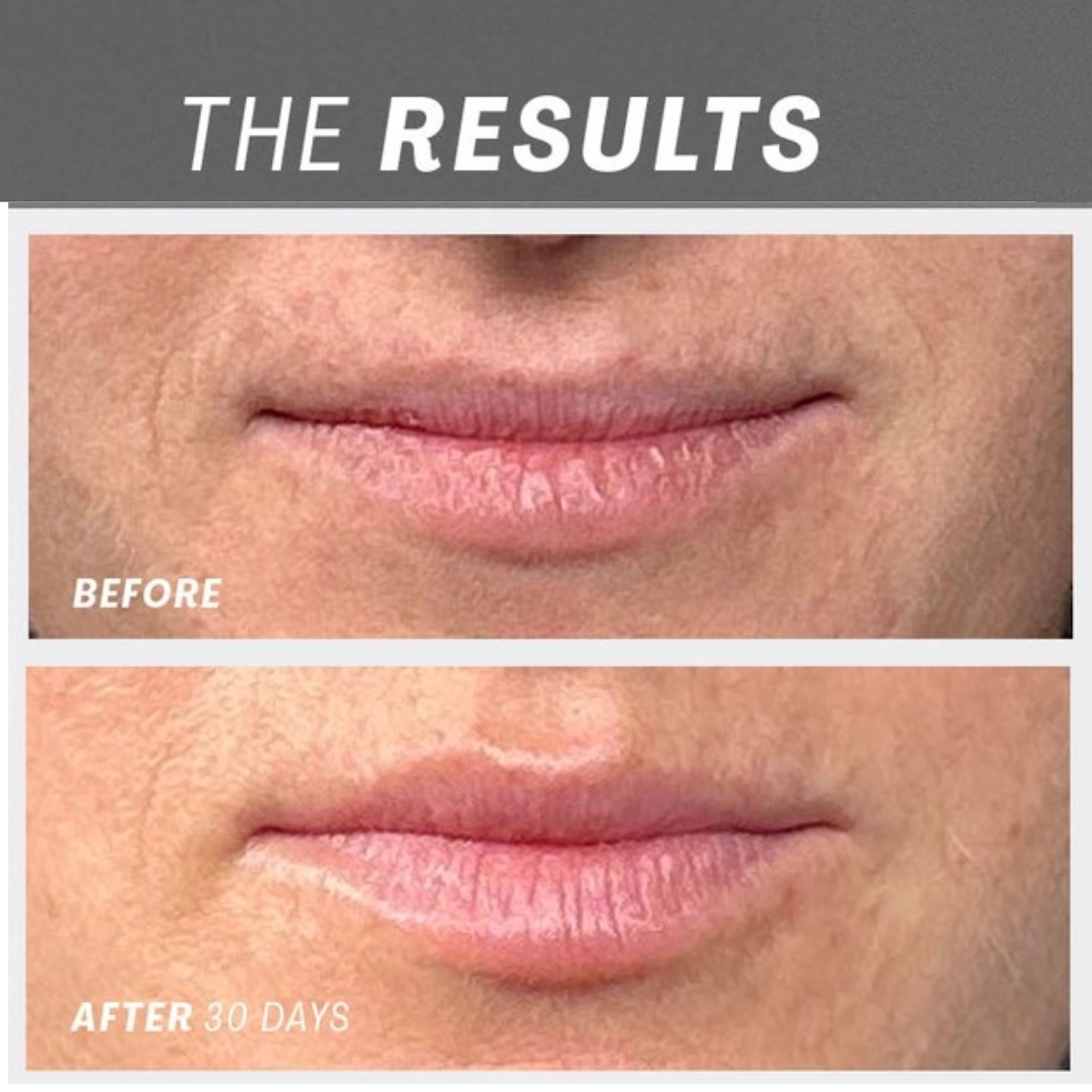 The Outset | Lip Oasisᵀᴹ Glossy Treatment - Image 6